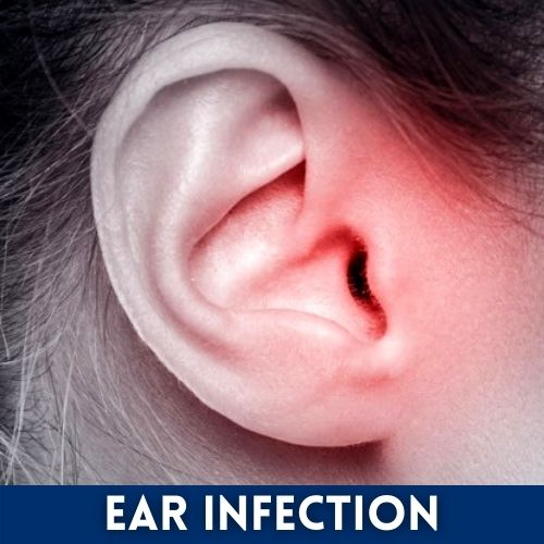 ear infection