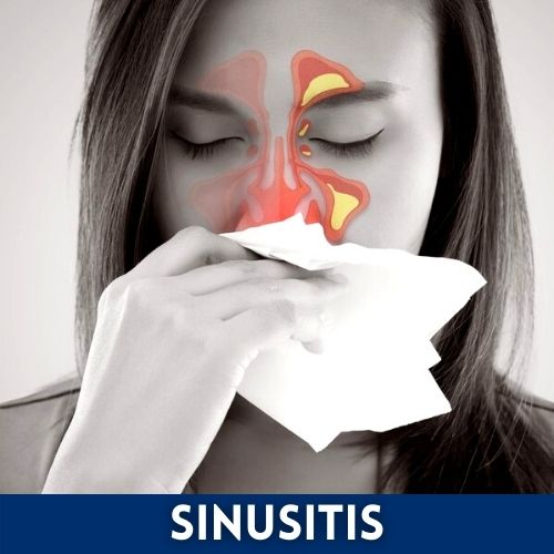 sinusitis