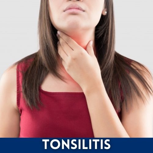 tonsilitis